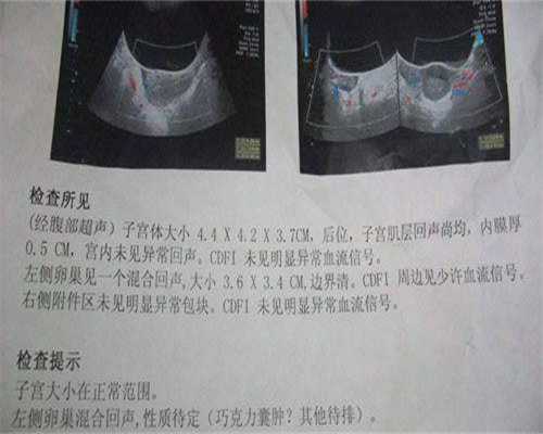 镇江私立生殖医院供卵，四川镇江较好的私立试管生殖医院有哪些？