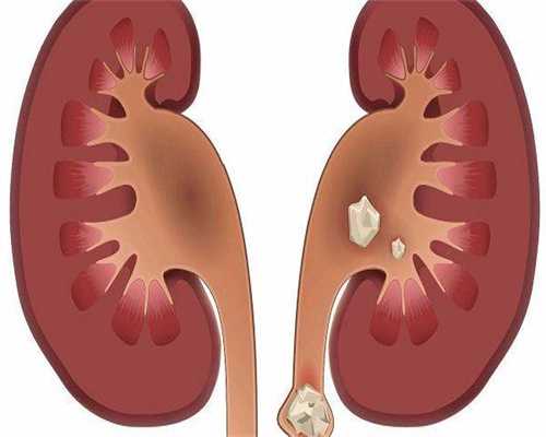 镇江做试管代怀详解的医院