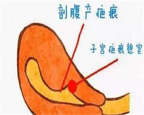 镇江供卵试管步骤，在镇江做试管孩有什么步骤？成功率高吗？