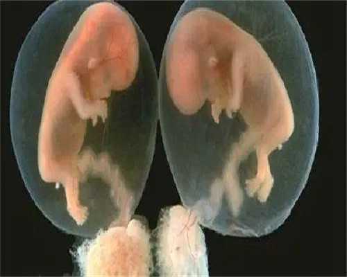 镇江助孕中心排名，镇江试管助孕中介