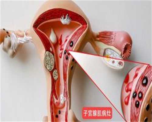 镇江供卵试管价目表，镇江西囡医院可以供卵吗