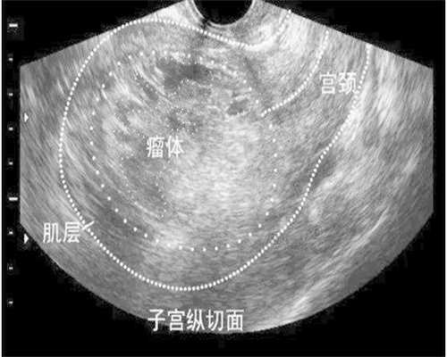 镇江代生怀孕，镇江代生
