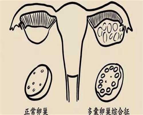 做试管卵巢不好会怎样调理？试管卵巢功能不好吃什么药