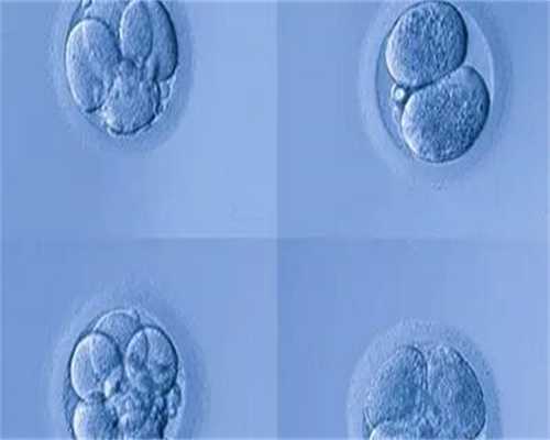 高龄二胎做试管婴儿前需要做哪些检查？