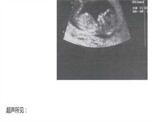 镇江52岁供精供卵，现在做供精的人多吗