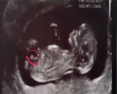 镇江双胞胎代怀价格是多少