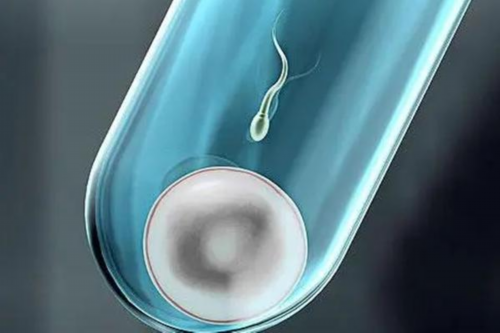 试管婴儿性别筛选:排卵障碍能做试管婴儿不？