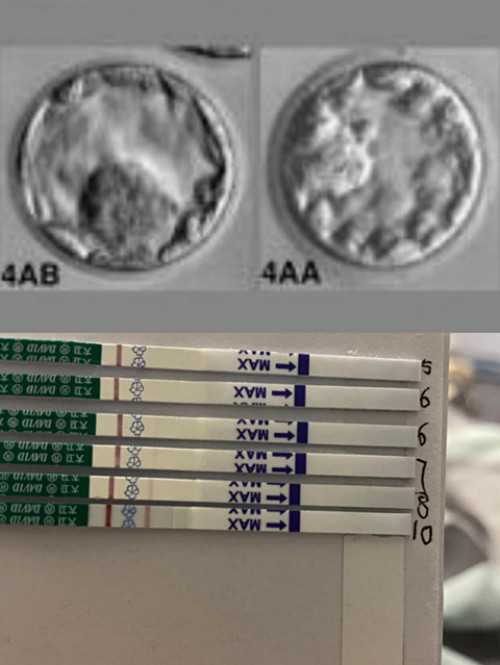 广东供卵试管中心，广东哪里能做供卵试管