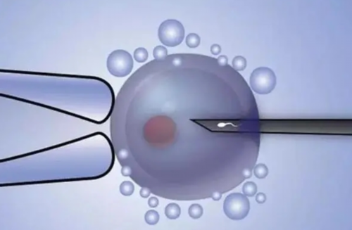 试管包男孩的国家_做试管生男孩广州妈妈,试管的方案都有哪些，分别适合哪些