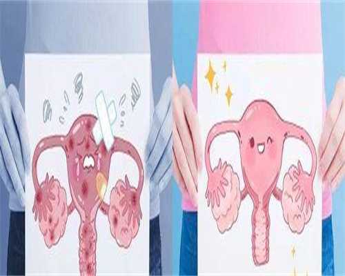 镇江供卵不用等，正式爆料!镇江供卵试管?