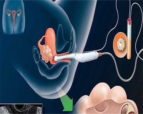 镇江代怀孕价格表-镇江代怀金陵生子网的背景
