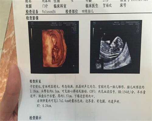 镇江最好的代孕医院-镇江男人代孕的条件