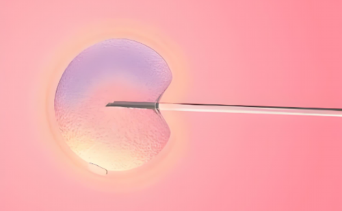 镇江高龄绝经供卵试管婴儿多少钱