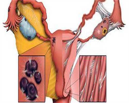 试管婴儿和人工受精有什么区别