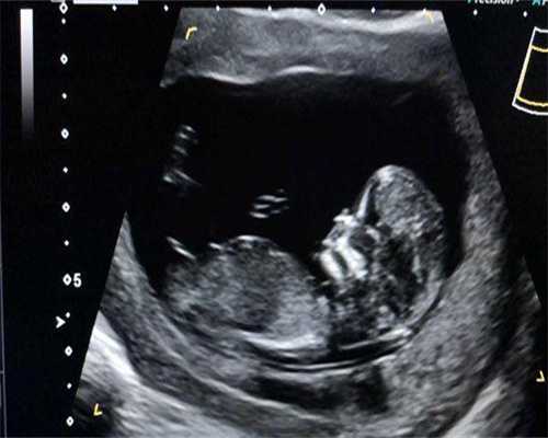 试管34岁取卵12个成功率高嘛为什么呢