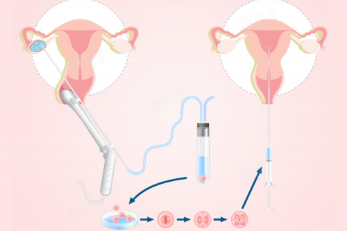 北京供卵靠谱的医院，北京家圆医院供卵费用