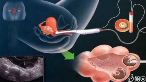 镇江代生男孩电话,孩子接触电脑不宜过早
