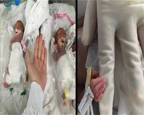 供卵代孕机构-卵泡检查结果怎么看，看懂卵泡监测单子一点也不难！