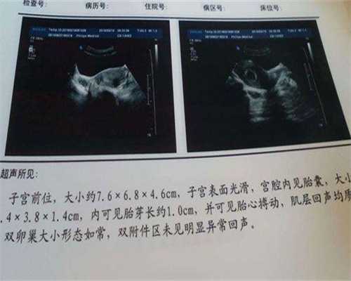 镇江能做供卵医院-镇江供卵试管婴儿费用