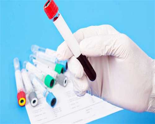 镇江代生那便宜,辅助生殖是什么意思