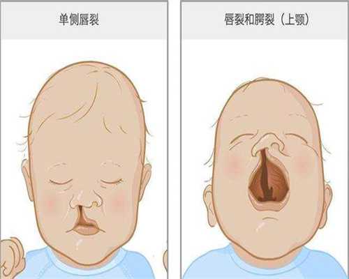 镇江代生好吗，镇江代生