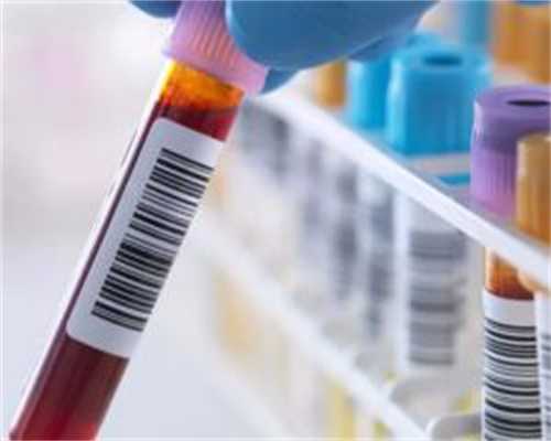 镇江供卵供精代怀，【深圳供卵试管中心镇江供卵试管成功率高吗】7月28排卵，