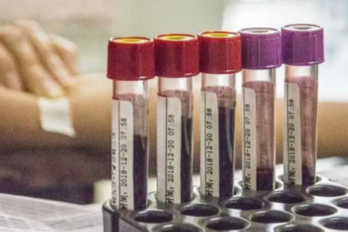 镇江有供卵机构吗-镇江供卵机构排名前十强