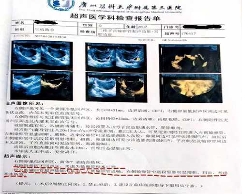 镇江代孕可靠吗，镇江捐卵代怀