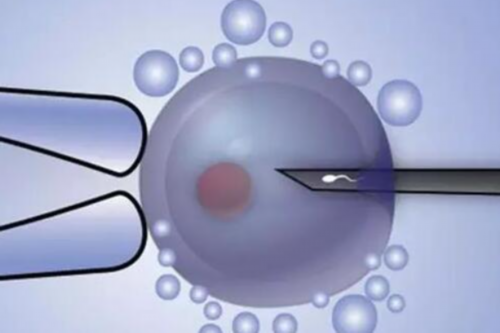 镇江正规助孕公司，镇江助孕公司找哪家好