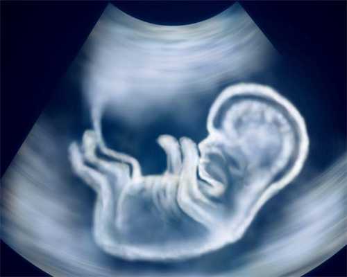 镇江哪里可以做供精-镇江供精哪家医院好？