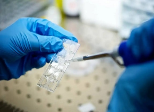 卵巢囊肿能治根吗