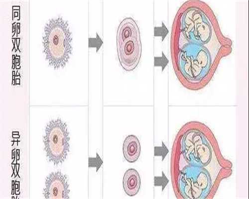 镇江代孕多少钱一次-镇江代孕市场概况