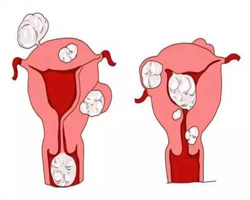 镇江高龄供卵试管婴儿费用
