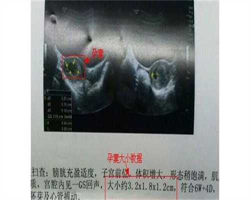 镇江第二代代孕费用，镇江做第三代试管婴儿多少钱