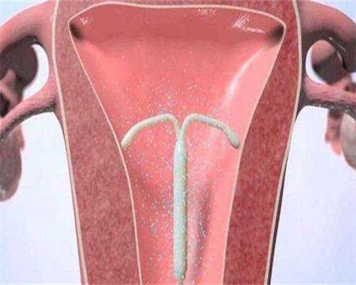 镇江代生可以同床吗,如果着床了可以同房吗