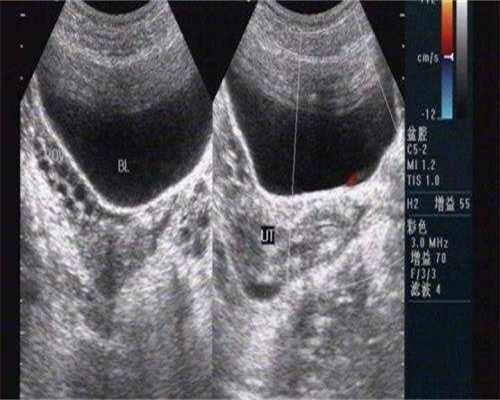 镇江供卵人工，镇江供卵医院如何选择？