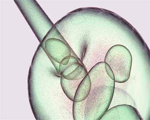 镇江试管私立医院有哪些_镇江试管技术