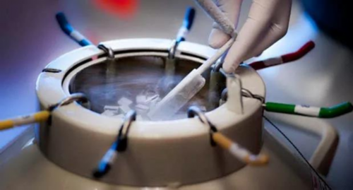 四川性别筛选，四川包性别