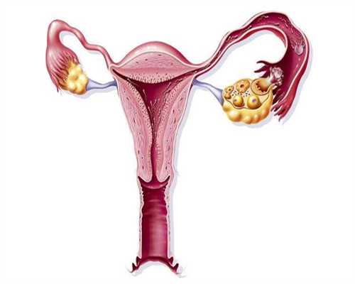 供卵机构:「促排卵有5个卵泡」做试管促排有5个卵泡