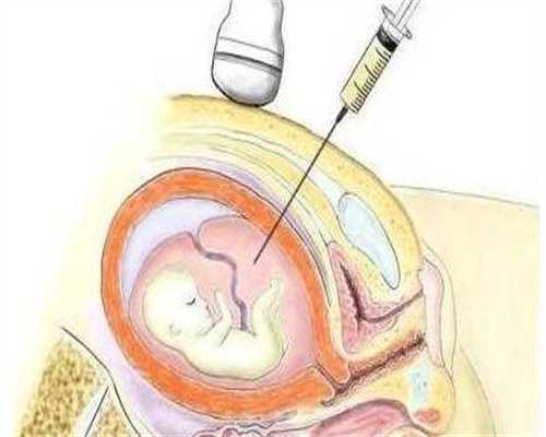 镇江代生中心，镇江代生