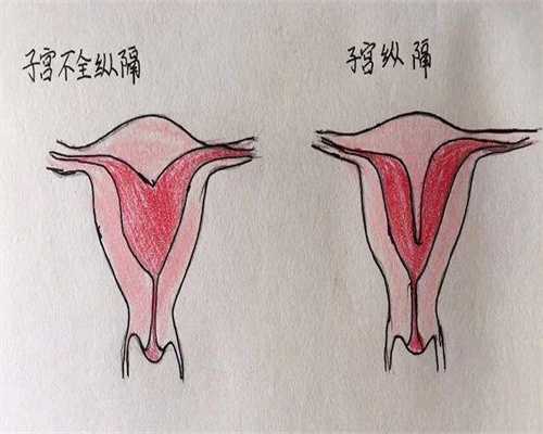 试管婴儿移植成功后，孕囊、胎心、胎芽多久能看见？