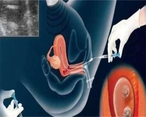 镇江助孕孩子费用高吗,「镇江三代试管」镇江三代试管婴儿多少费用