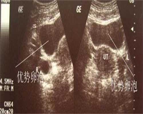 镇江代生机构医院-镇江代生的费用